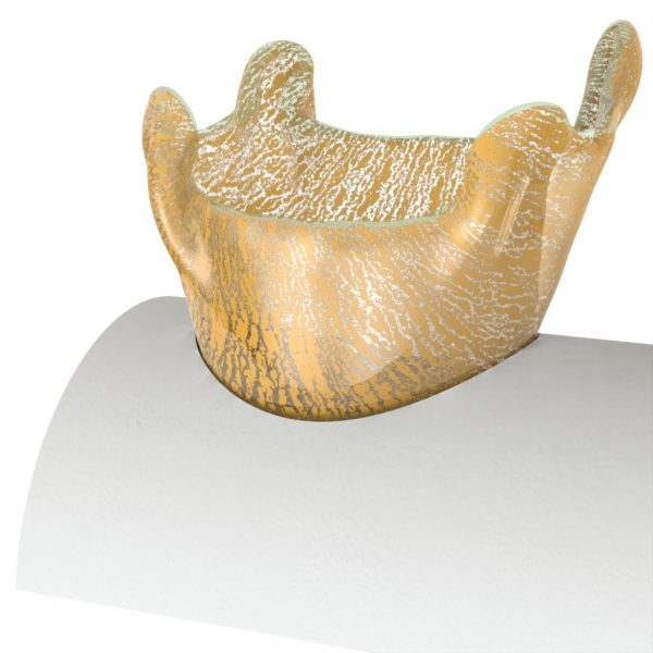 Serving Bowl & Stand - Image 3